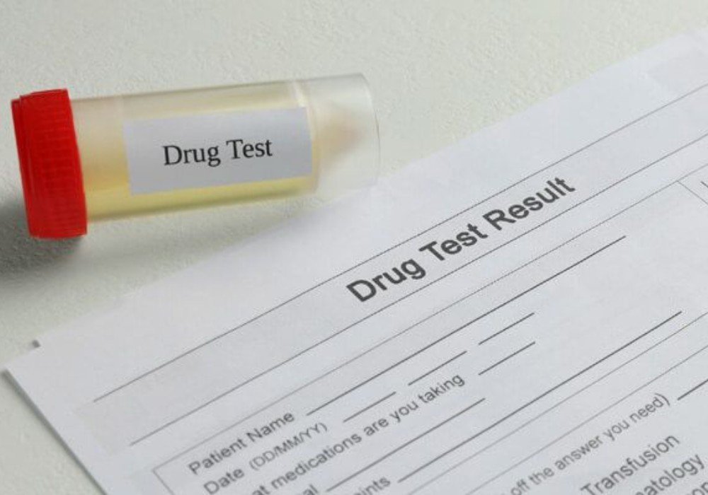 Understanding Urine Drug Testing: Processes, Benefits, and Accuracy